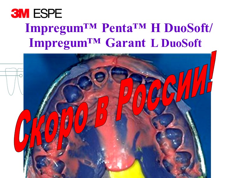 Скоро в России! Impregum™ Penta™ H DuoSoft/ Impregum™ Garant  L DuoSoft